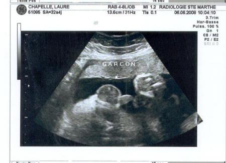 �chographie du 3�me trimestre.