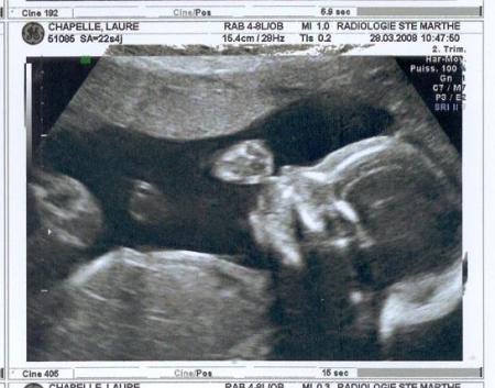 �chogaphie du 2�me trimestre.