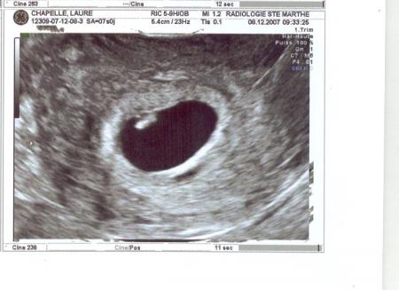 �chographie de datation.